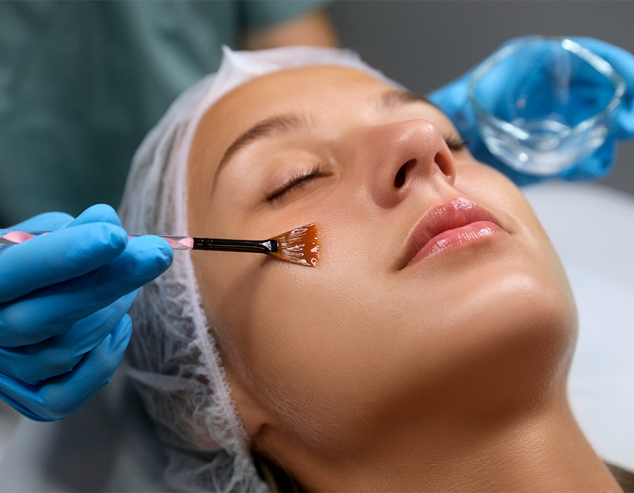 Centro de estética Avanzada Cuida-T peeling facial